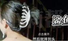 鯊魚夾是有危害的！女子頭戴鯊魚夾摔倒后成植物人