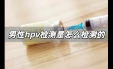 男性hpv檢測是怎么檢測的 男性查hpv是抽血嗎